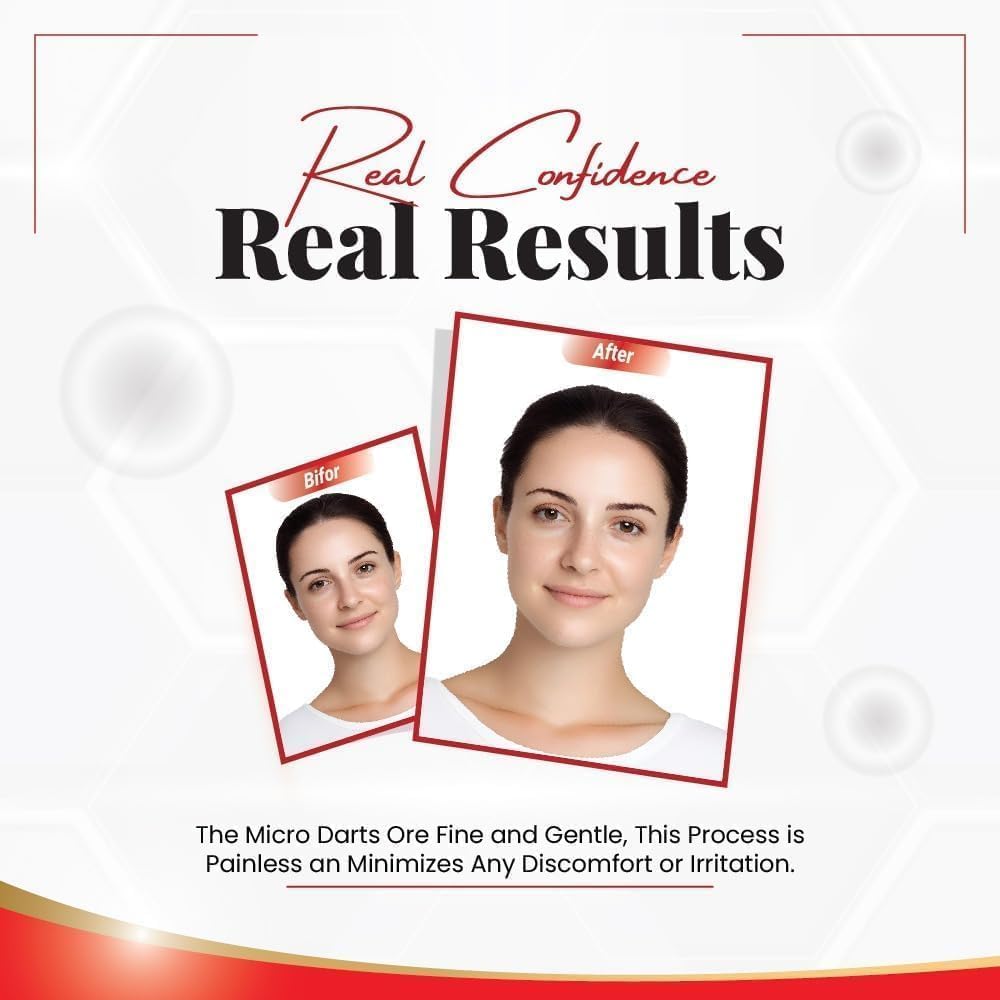 Pack of 72 Derma Smooth Skin Tag Removal