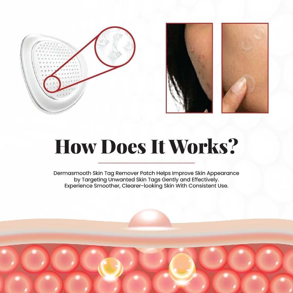 Pack of 72 Derma Smooth Skin Tag Removal